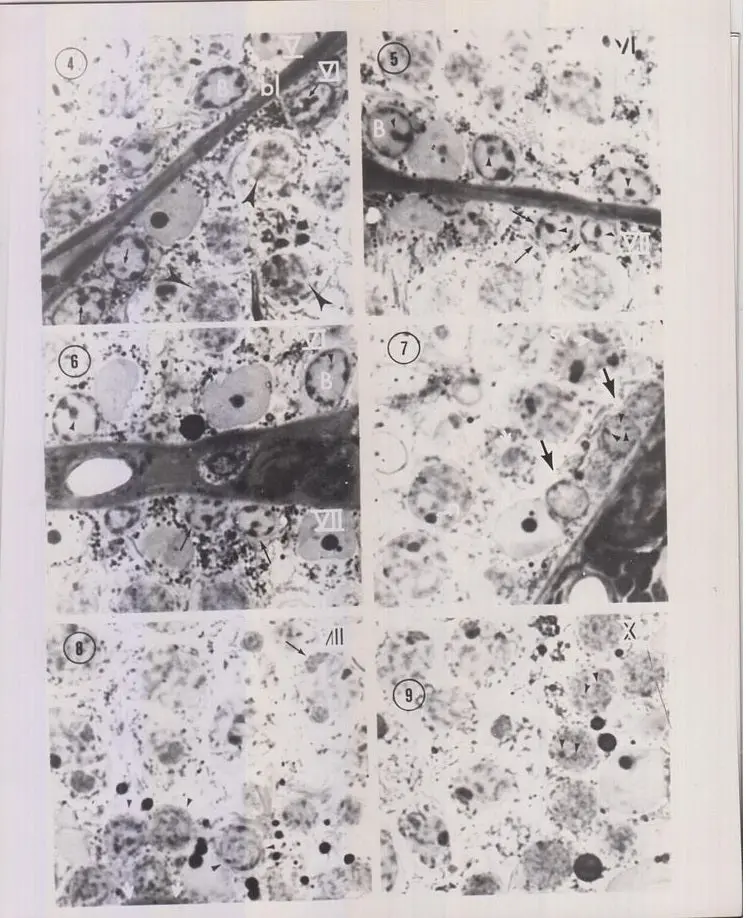 Characterization Of Rat Spermatocytes After Plastic Embedding  By Russell, L., B. Frank 1